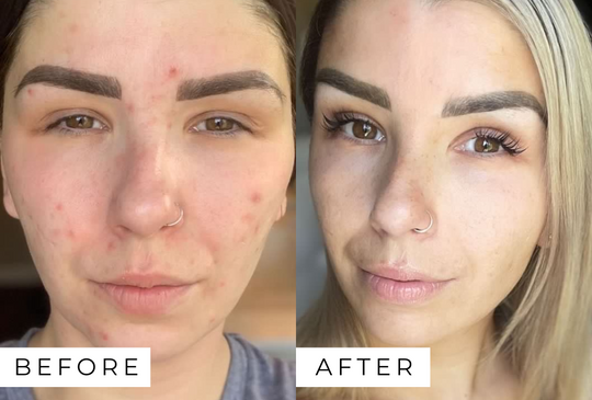 "My skin has never ever looked or felt better"